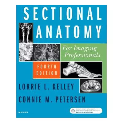 Sectional Anatomy for Imaging Professionals - E-Book