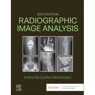 Radiographic Image Analysis - E-Book